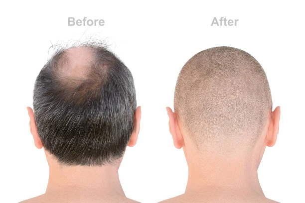 Moustache & Beard Hair Reconstruction